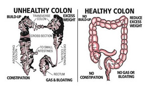 healthy_and_unhealthy_colon